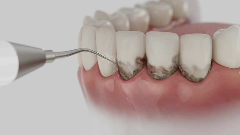Reliable Dental Implants contractor in Augusta, ME by Smile Center Dentistry